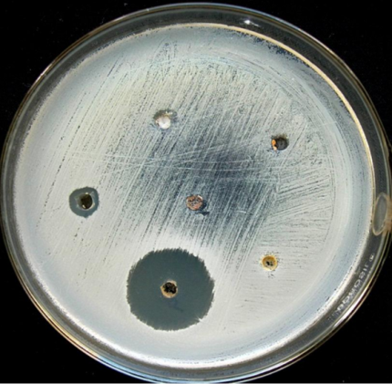 Actividad antibiótica de un actinomiceto sobre Staphylococcus aureus (bacteria)(http://bioresonline.org/article/isolation-and-characterization-of-antibiotics-producing-actinomycetes-from-soil-samples-of-senbagadaruvi-in-western-ghats-2/)